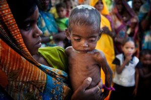 GS2 : Hunger and Malnutrition in India